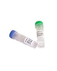 Cytiva illustra ExoProStar Enzymatic PCR clean up technology illustra Exonuclease I and Alkaline