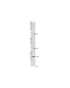 Cell Signaling Lc3 Control Cell Extracts