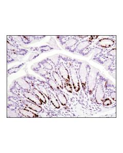 Cell Signaling Ki-67 (D3b5) Rabbit mAb (Mouse Preferred; Ihc Formulated)