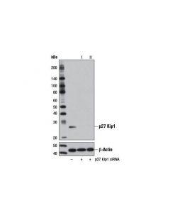Cell Signaling Signalsilence P27 Kip1 Sirna I