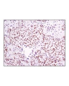 Cell Signaling Ercc1 (D6g6) Xp Rabbit mAb