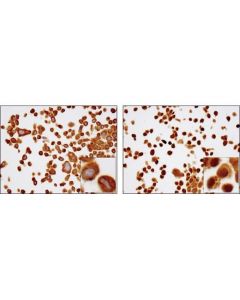 Cell Signaling Signalslide  Nf-Kappab P65 Ihc Controls