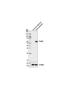 Cell Signaling Foxc2 (D4d4) Rabbit mAb