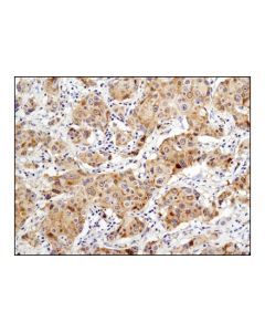 Cell Signaling Rkip (D42f3) Rabbit mAb