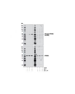 Cell Signaling Phospho-Pfkfb2 (Ser483) (D4r1w) Rabbit mAb