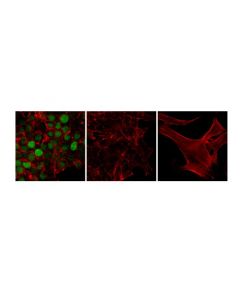Cell Signaling Phospho-Topoisomerase Iialpha (Ser1469) (D4f5) Rabbit mAb