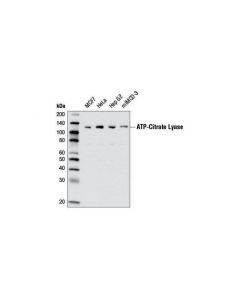Cell Signaling Atp-Citrate Lyase (D1x6p) Rabbit mAb