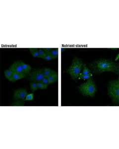 Cell Signaling Atg13 (E1y9v) Rabbit mAb