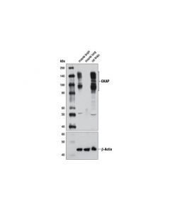 Cell Signaling Gkap Antibody