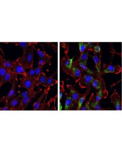 Cell Signaling Gabarap (E1j4e) Rabbit mAb