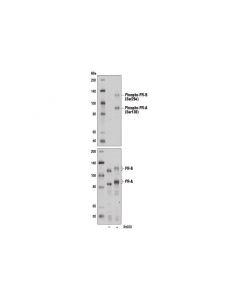 Cell Signaling Phospho-Progesterone Receptor (Ser294) Antibody