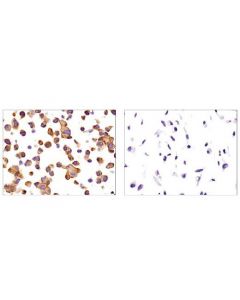 Cell Signaling Signalslide  Lkb1 Ihc Controls