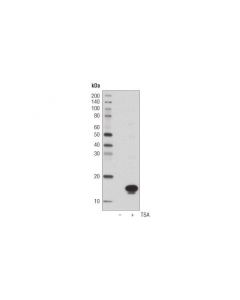 Cell Signaling Acetyl-Histone H3 (Lys27) (D5e4) Xp  Rabbit mAb (Hrp Conjugate)