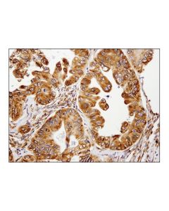 Cell Signaling Lyric/Metadherin (D5y8r) Xp Rabbit mAb