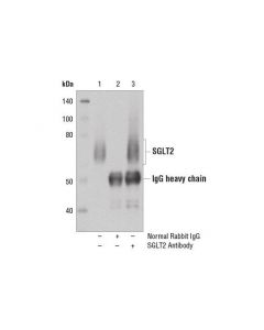 Cell Signaling Sglt2 Antibody