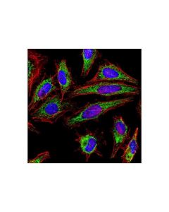Cell Signaling Citrate Synthase (D7v8b) Rabbit mAb