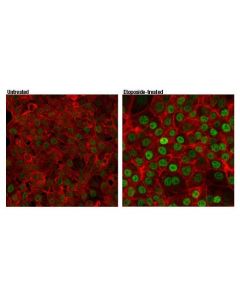 Cell Signaling P73 (D3g10) Rabbit mAb