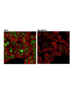 Cell Signaling Xpc (D1m5y) Rabbit mAb