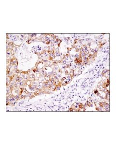 Cell Signaling Lsr (D3e3n) Xp Rabbit mAb