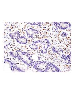 Cell Signaling Ifi16 (D8b5t) Rabbit mAb