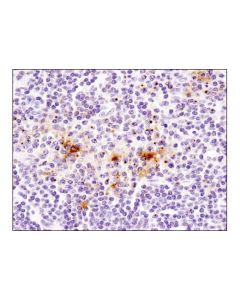 Cell Signaling Cd40 Ligand (D5j9y) Rabbit mAb