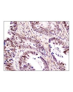 Cell Signaling Brd7 (D9k2t) Rabbit mAb