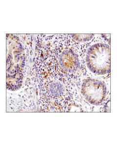Cell Signaling Igf-Ii Receptor/Ci-M6pr (D8z3j) Rabbit mAb