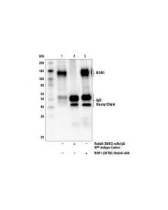 Cell Signaling Ror1 (D6t8c) Rabbit mAb