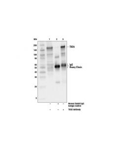 Cell Signaling Tks5 Antibody