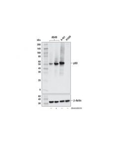 Cell Signaling P53 (Do-1) Mouse mAb