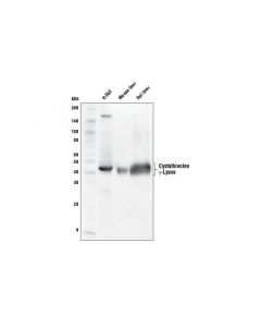 Cell Signaling Cystathionine Gamma-Lyase (D1n1d) Rabbit mAb