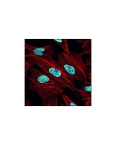 Cell Signaling Ku80 (C48e7) Rabbit mAb