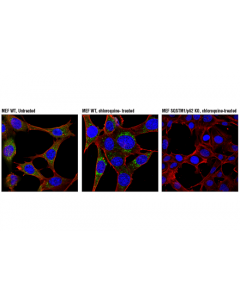 Cell Signaling Sqstm1/P62 (D6m5x) Rabbit mAb (Rodent Specific)