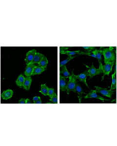 Cell Signaling Merlin/Ezrin/Radixin/Moesin (D1p8i) Rabbit mAb