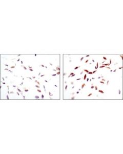 Cell Signaling Phospho-Ampkalpha (Thr172) (40h9) Rabbit mAb