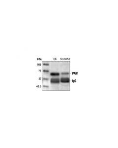 Cell Signaling Pak1 Antibody