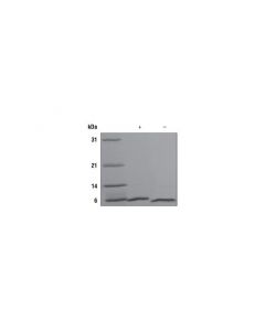 Cell Signaling Human Nrg1-Beta1 Recombinant Protein