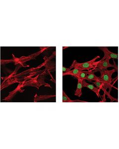 Cell Signaling Irf-9 (D9i5h) Rabbit mAb (Mouse Specific)
