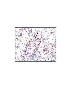 Cell Signaling Cyclin D3 (Dcs22) Mouse mAb