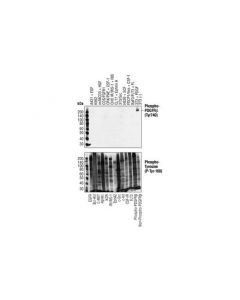 Cell Signaling Phospho-Pdgf Receptor Beta (Tyr740) (32a9) Rabbit mAb