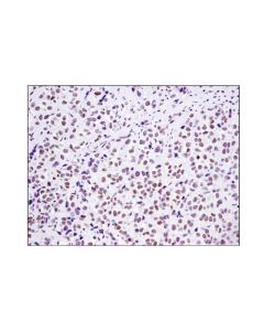 Cell Signaling Utx (D3q1i) Rabbit mAb