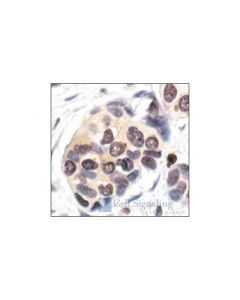 Cell Signaling Branched Ubiquitin Antibody Sampler Kit