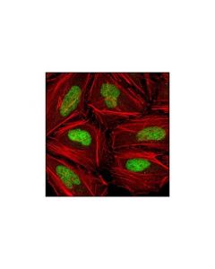 Cell Signaling Chk2 (1c12) Mouse mAb
