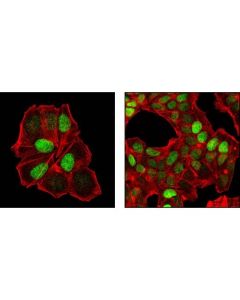 Cell Signaling P27 Kip1 (Sx53g8.5) Mouse mAb