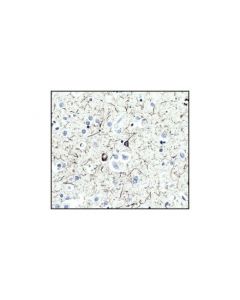 Cell Signaling Tau (Tau46) Mouse mAb