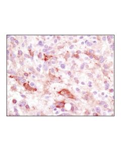 Cell Signaling Lc3a (D50g8) Xp Rabbit mAb