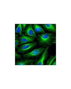 Cell Signaling Cellular Localization If Antibody Sampler Kit
