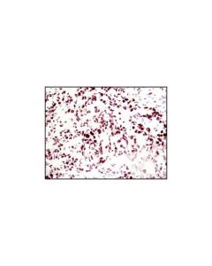 Cell Signaling Mre11 (31h4) Rabbit mAb
