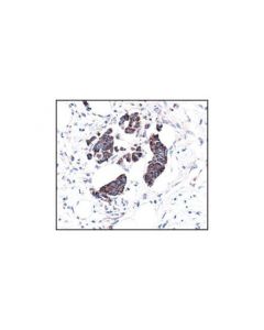 Cell Signaling Vdac Antibody