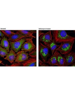 Cell Signaling Bafilomycin A1